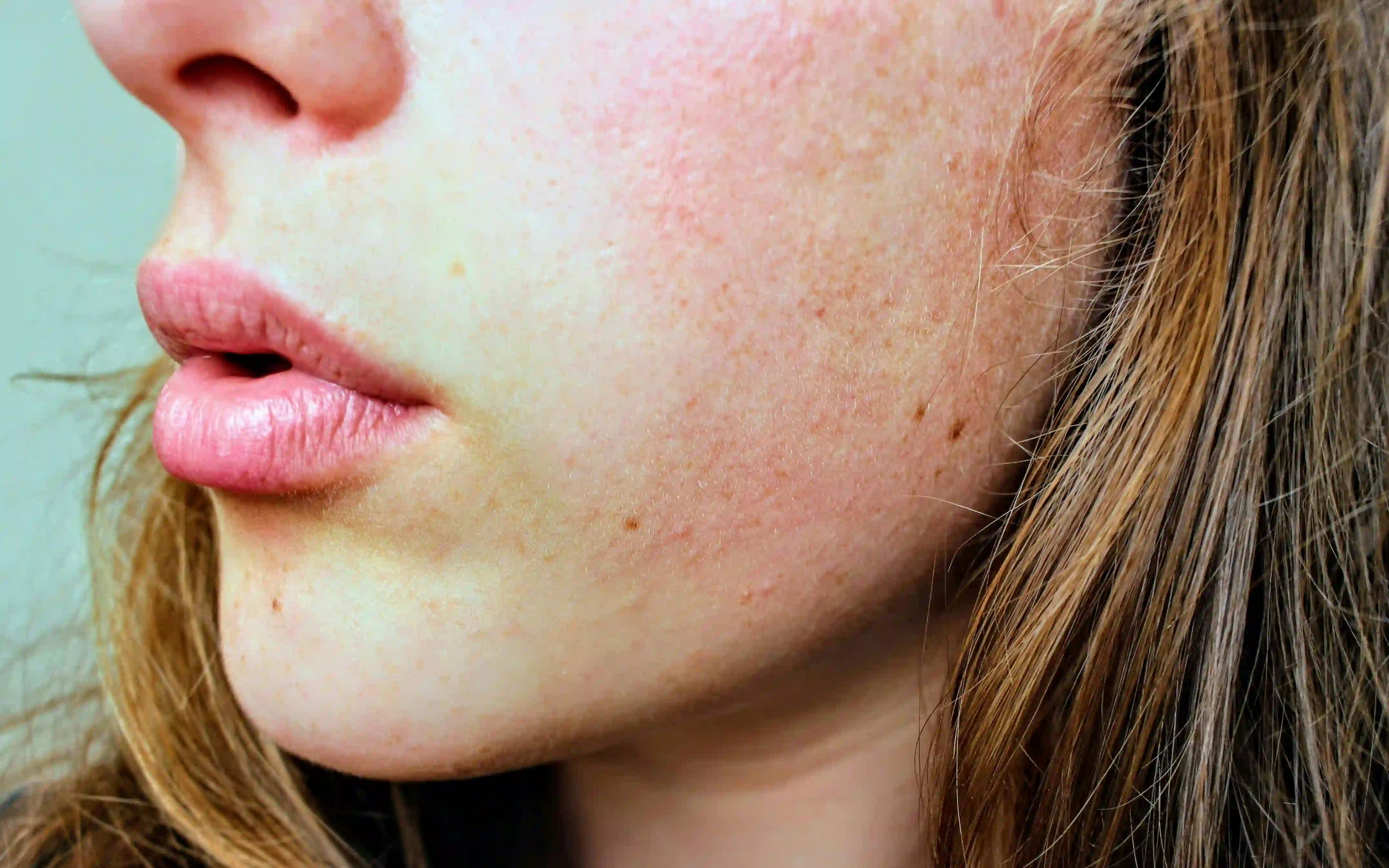 Les 5 erreurs qui détruisent l’hydratation de votre peau Image